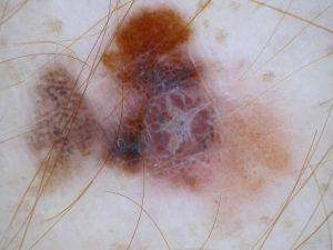 Pattern multicomponente